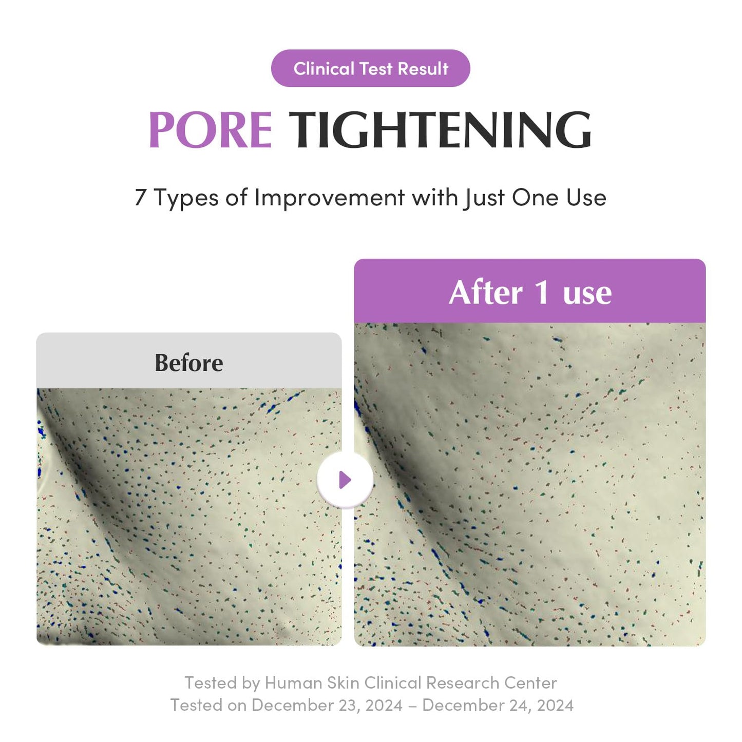 EQQUALBERRY Purple PDRN Pore Minimizing Serum