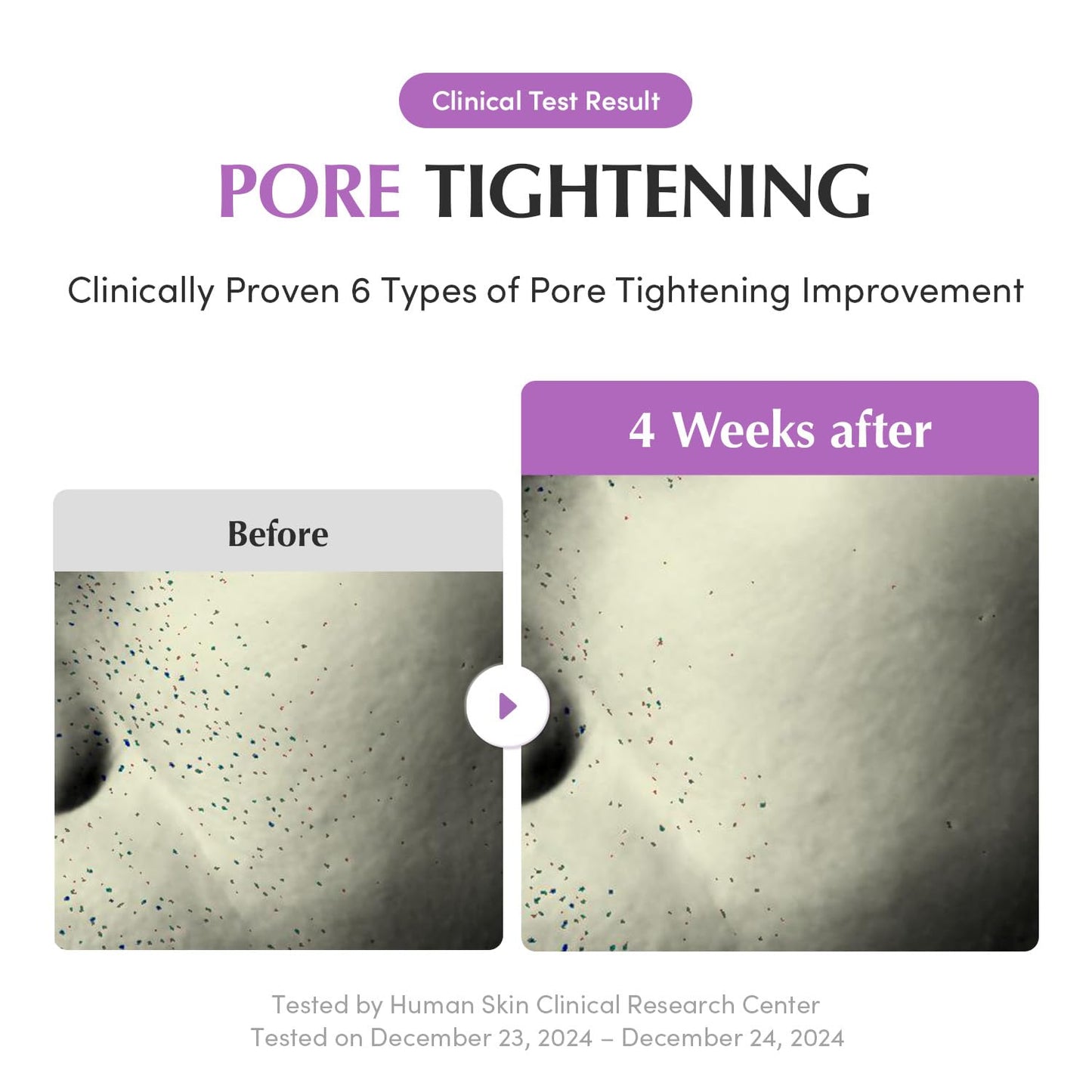 EQQUALBERRY Purple PDRN Pore Minimizing Serum