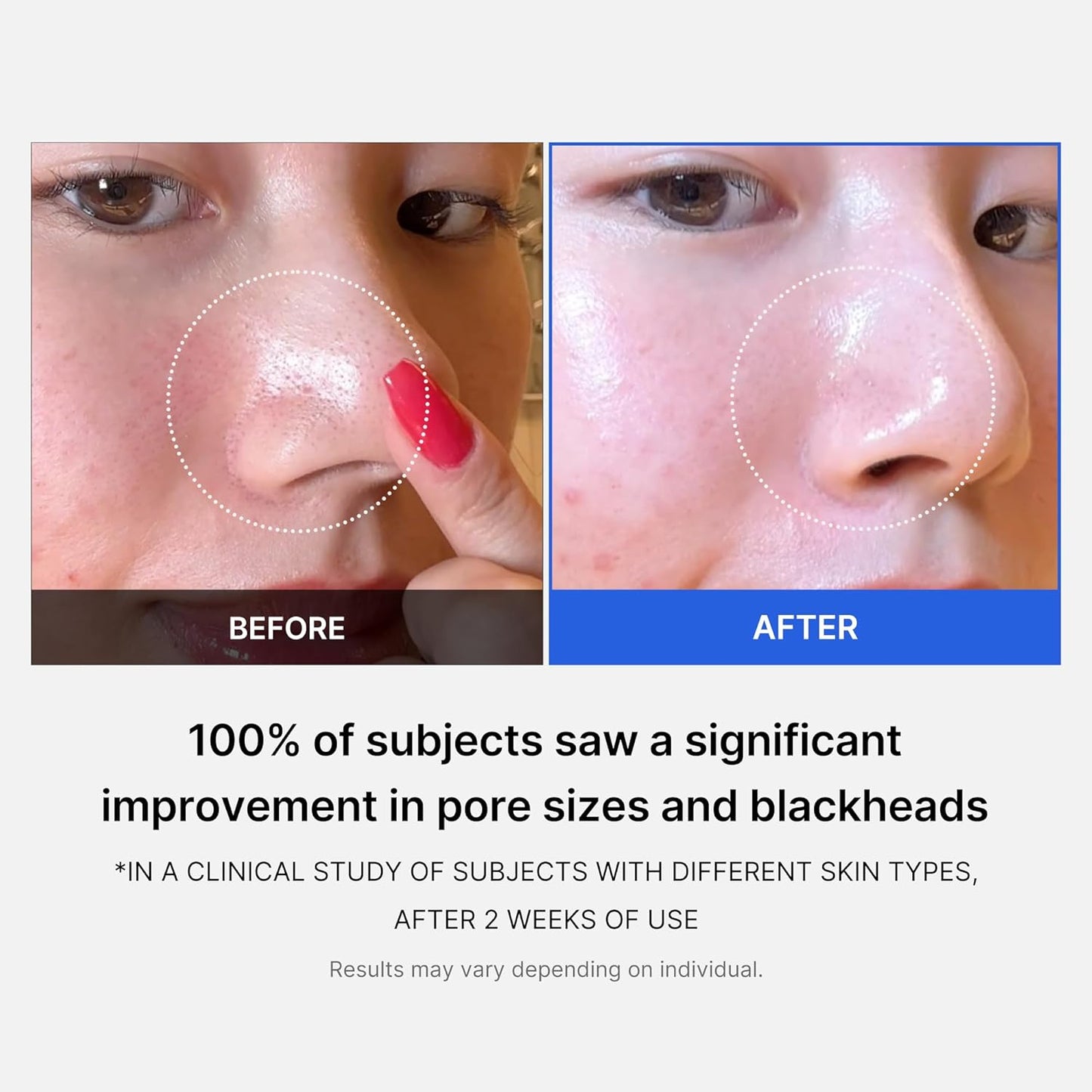 Medicube Zero Pore Pads - 70 pads
