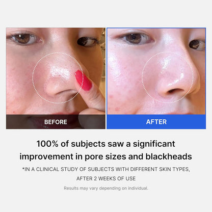 Medicube Zero Pore Pads - 70 pads